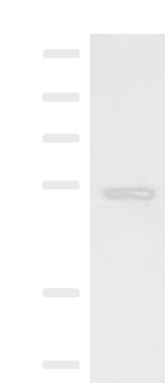 Western blot analysis of Rat liver tissue lysate  using ONECUT1 Polyclonal Antibody at dilution of 1:600