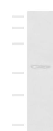 Western blot analysis of NIH/3T3 cell lysate  using HOXD9 Polyclonal Antibody at dilution of 1:1000