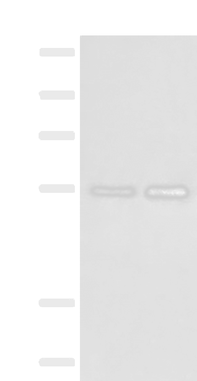 Western blot analysis of Human placenta tissue and 231 cell lysates  using HTRA4 Polyclonal Antibody at dilution of 1:400