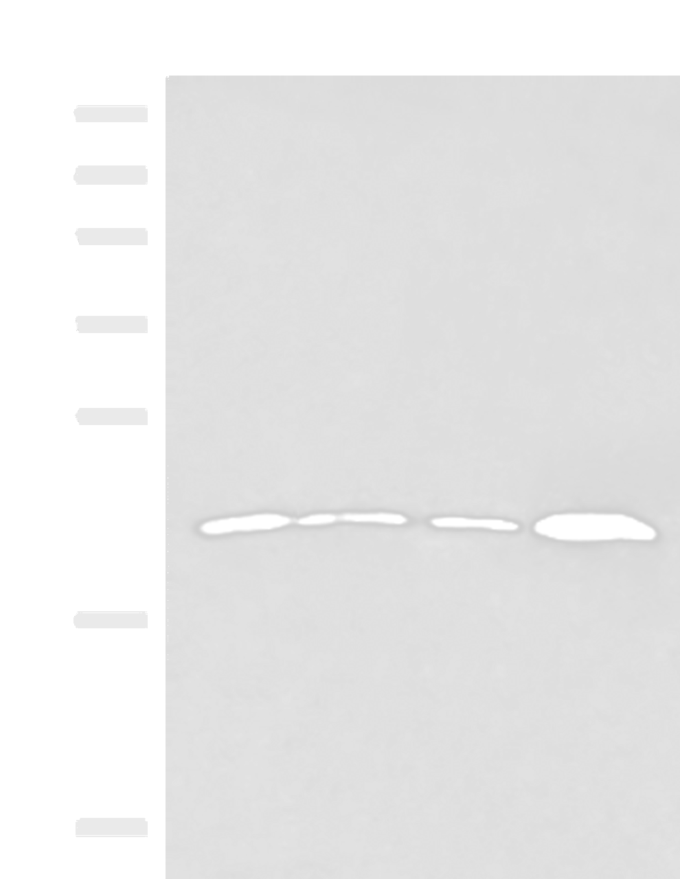 Western blot analysis of 231 cell Human breast cancer tissue Raji cell Human fetal liver tissue lysates  using IFNA5 Polyclonal Antibody at dilution of 1:400