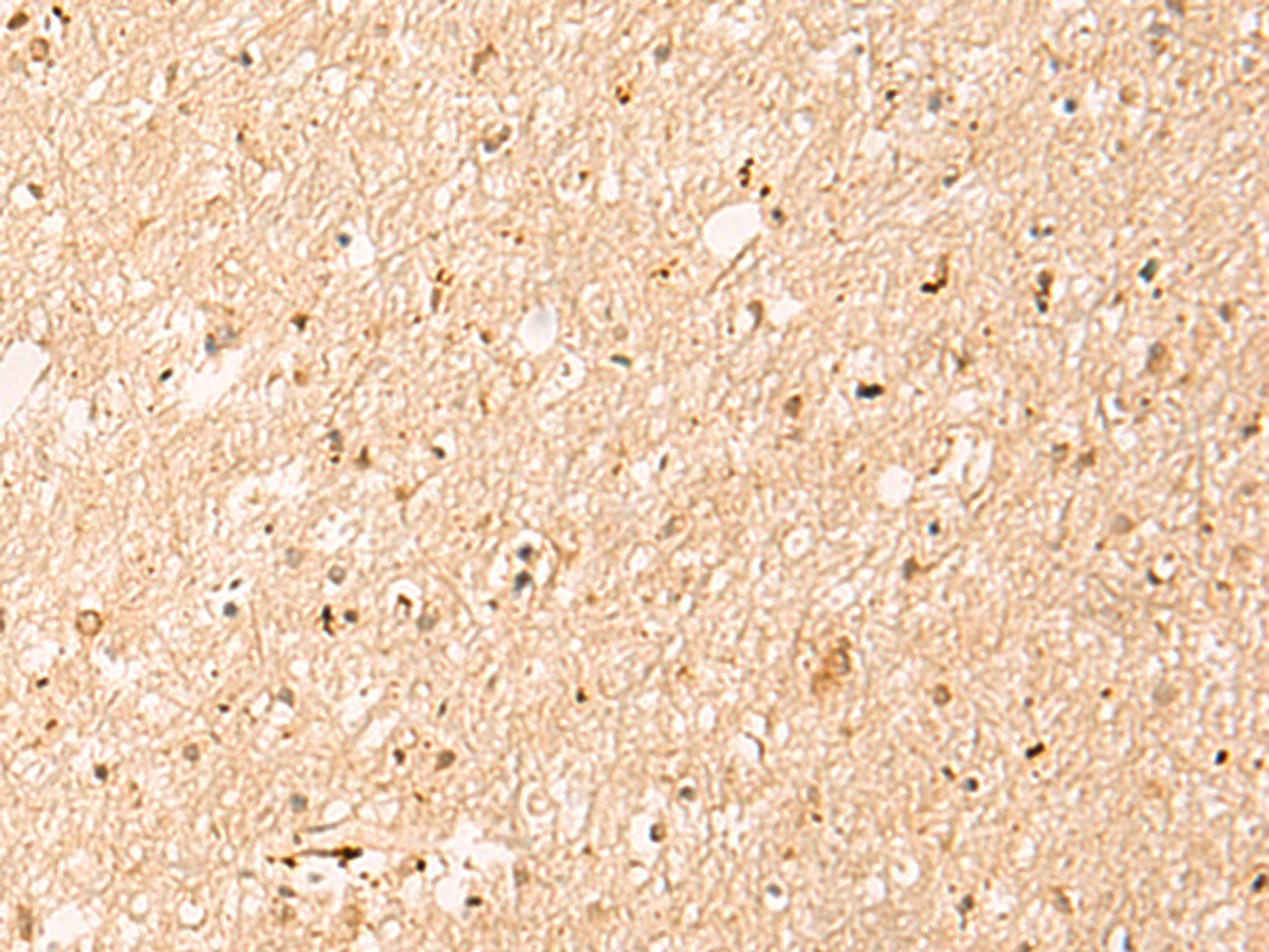 Immunohistochemistry of paraffin-embedded Human brain tissue  using IL1RAPL2 Polyclonal Antibody at dilution of 1:25(×200)
