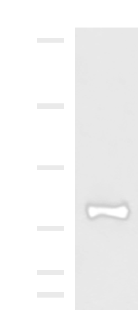 Western blot analysis of TM4 cell lysate  using FOXK2 Polyclonal Antibody at dilution of 1:1000