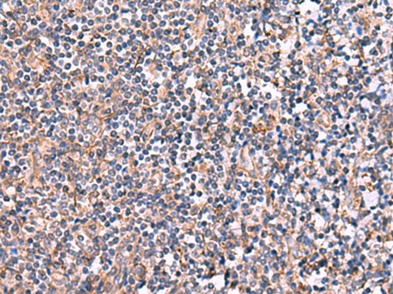 Immunohistochemistry of paraffin-embedded Human tonsil tissue  using INPP5B Polyclonal Antibody at dilution of 1:40(×200)