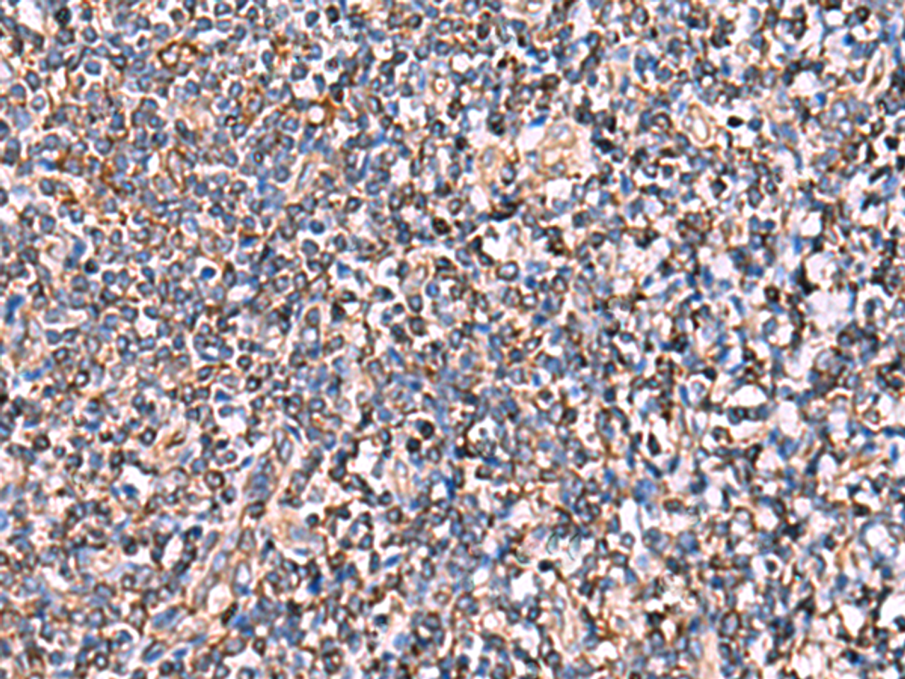 Immunohistochemistry of paraffin-embedded Human tonsil tissue  using INSC Polyclonal Antibody at dilution of 1:65(×200)