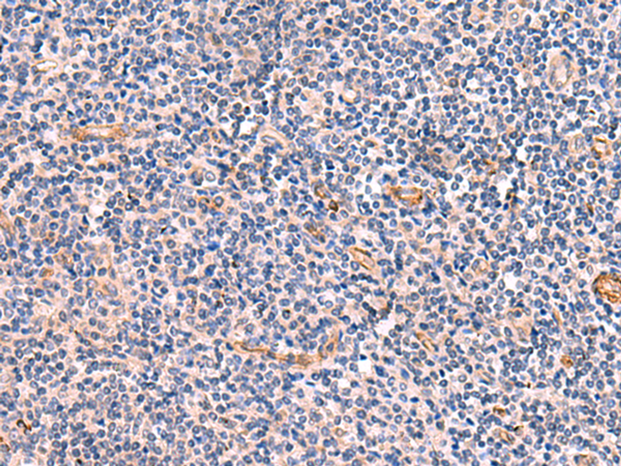 Immunohistochemistry of paraffin-embedded Human tonsil tissue  using INSM2 Polyclonal Antibody at dilution of 1:35(×200)