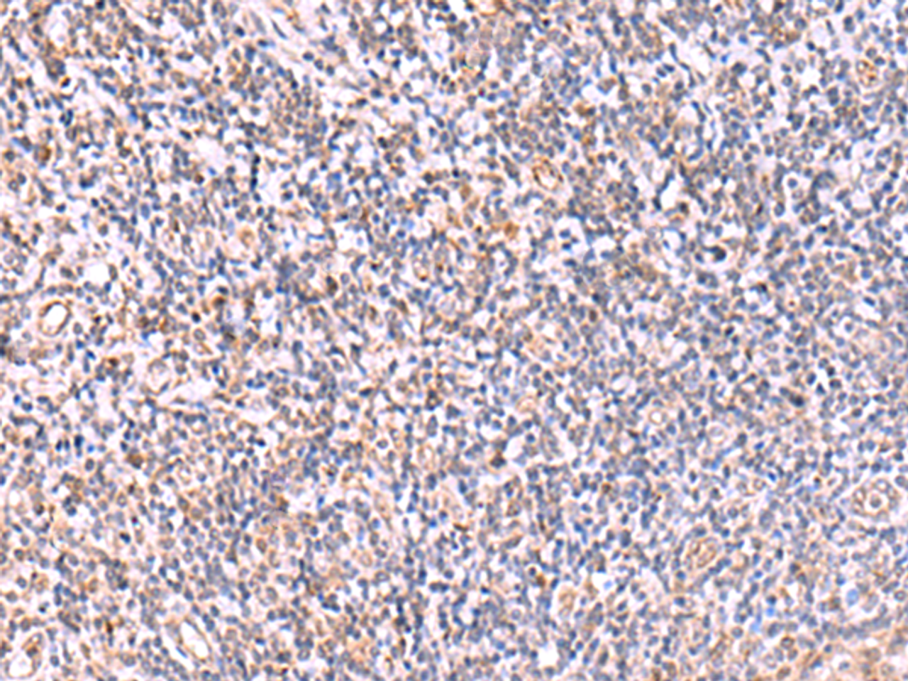 Immunohistochemistry of paraffin-embedded Human tonsil tissue  using ITPKC Polyclonal Antibody at dilution of 1:40(×200)