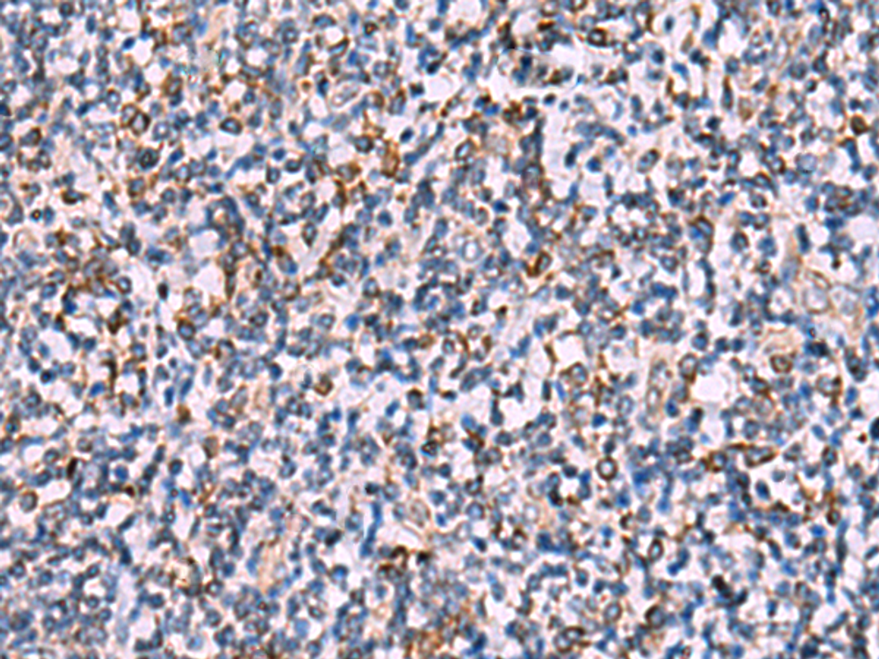 Immunohistochemistry of paraffin-embedded Human tonsil tissue  using IPPK Polyclonal Antibody at dilution of 1:30(×200)
