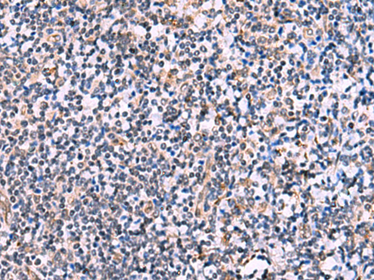 Immunohistochemistry of paraffin-embedded Human tonsil tissue  using NMRK2 Polyclonal Antibody at dilution of 1:55(×200)