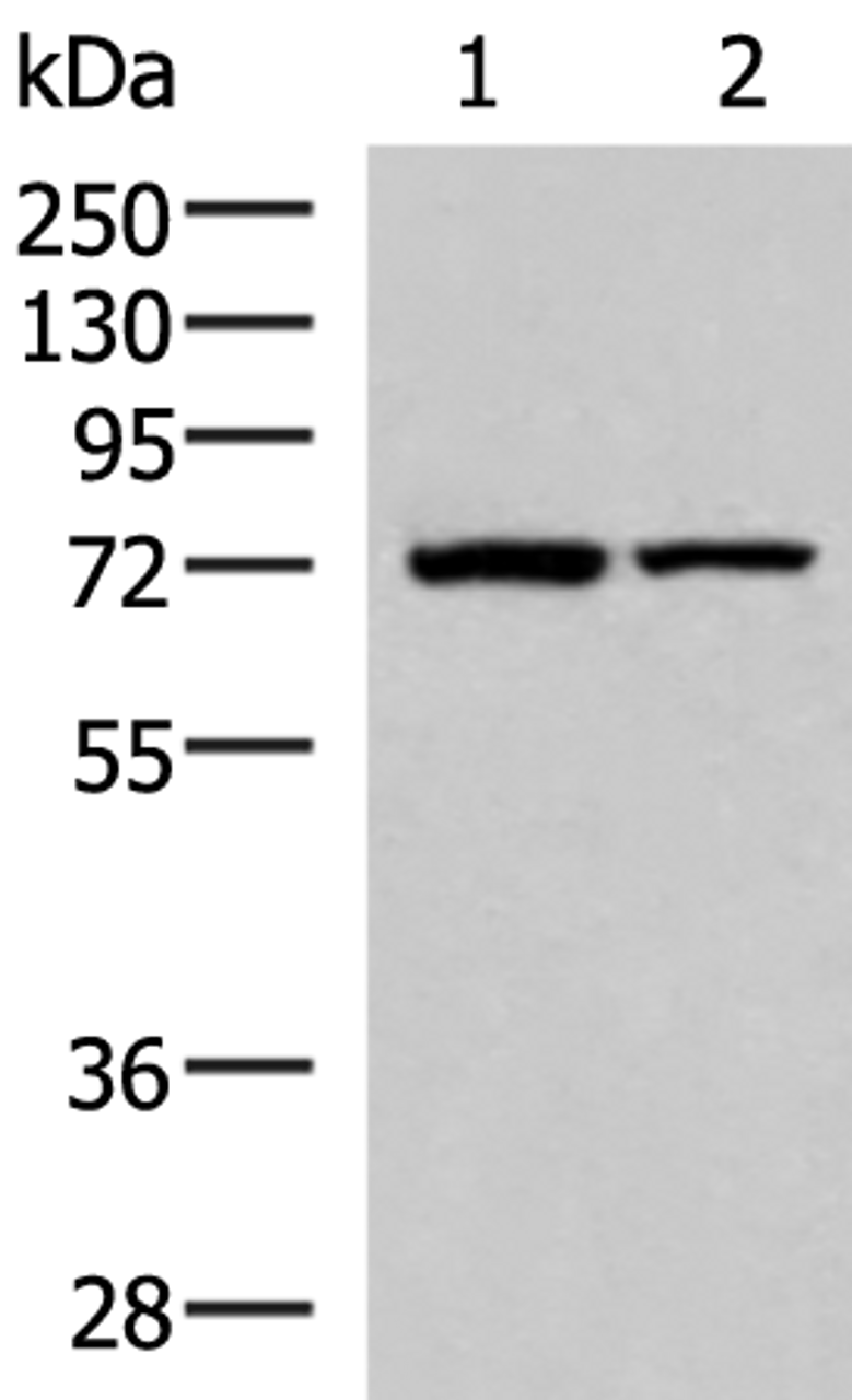 Western blot analysis of Mouse heart tissue and Mouse skeletal muscle tissue lysates  using JPH1 Polyclonal Antibody at dilution of 1:800