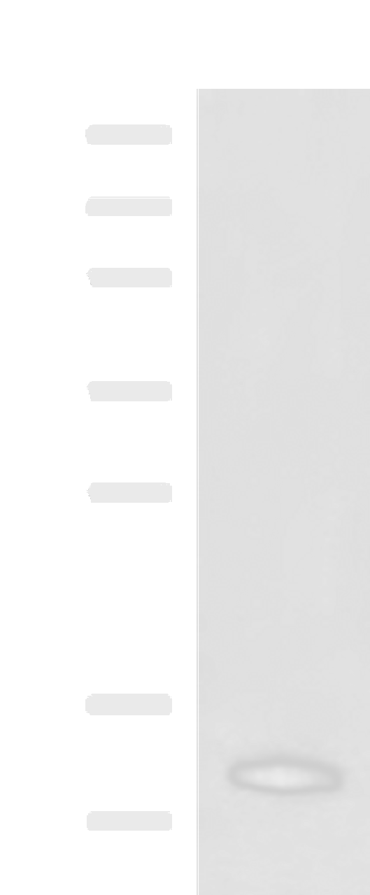 Western blot analysis of Rat pancreas tissue lysate  using PPY Polyclonal Antibody at dilution of 1:2500