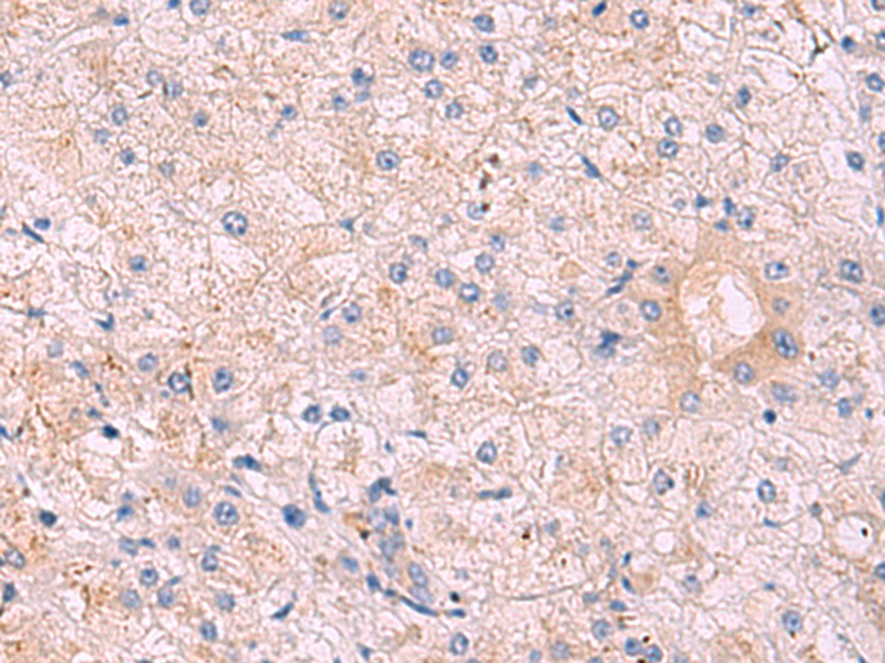 Immunohistochemistry of paraffin-embedded Human tonsil tissue  using KANSL1L Polyclonal Antibody at dilution of 1:40(×200)