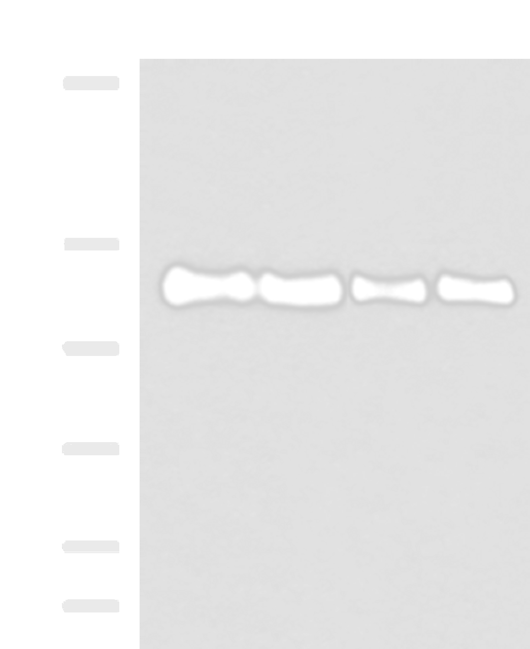 Western blot analysis of 293T HEPG2 Hela and TM4 cell lysates  using TRIM28(phospho-Ser824) Polyclonal Antibody at dilution of 1:1000