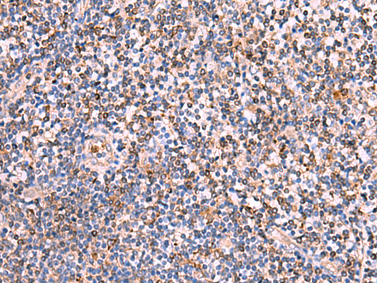 Immunohistochemistry of paraffin-embedded Human tonsil tissue  using SOX2 Polyclonal Antibody at dilution of 1:35(×200)