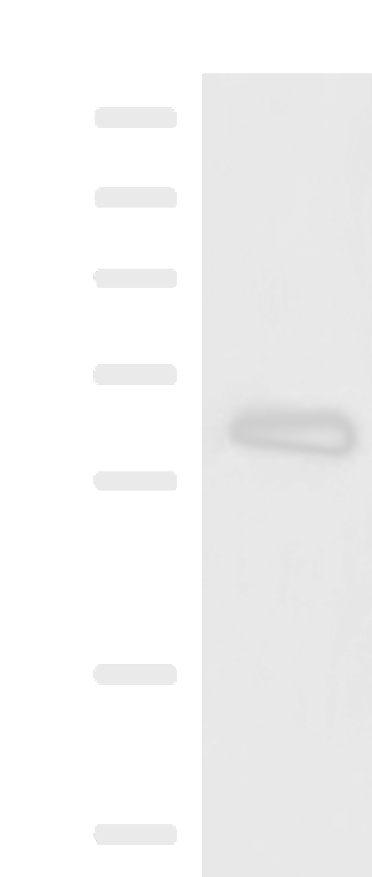 Western blot analysis of Human metastatic papillary carcinoma(thyroid cancer) tissue lysate  using KBTBD11 Polyclonal Antibody at dilution of 1:2300