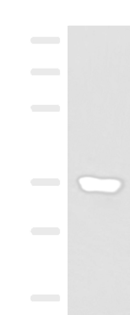 Western blot analysis of Human muscle tissue lysate  using KCNK15 Polyclonal Antibody at dilution of 1:1000