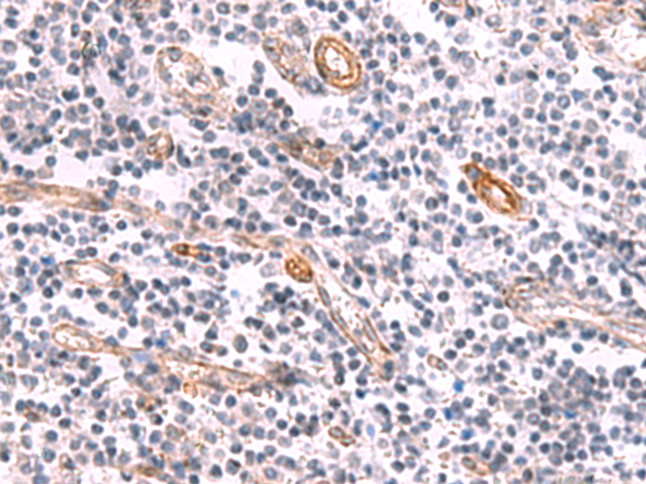 Immunohistochemistry of paraffin-embedded Human tonsil tissue  using KCNK15 Polyclonal Antibody at dilution of 1:45(×200)