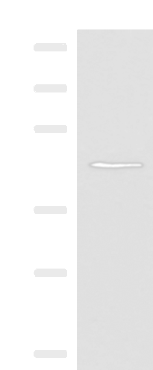 Western blot analysis of TM4 cell lysate  using KCNK18 Polyclonal Antibody at dilution of 1:800