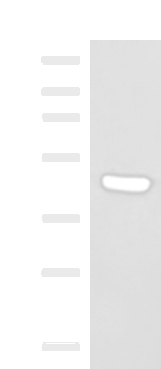 Western blot analysis of Hela cell lysate  using KCTD7 Polyclonal Antibody at dilution of 1:1200