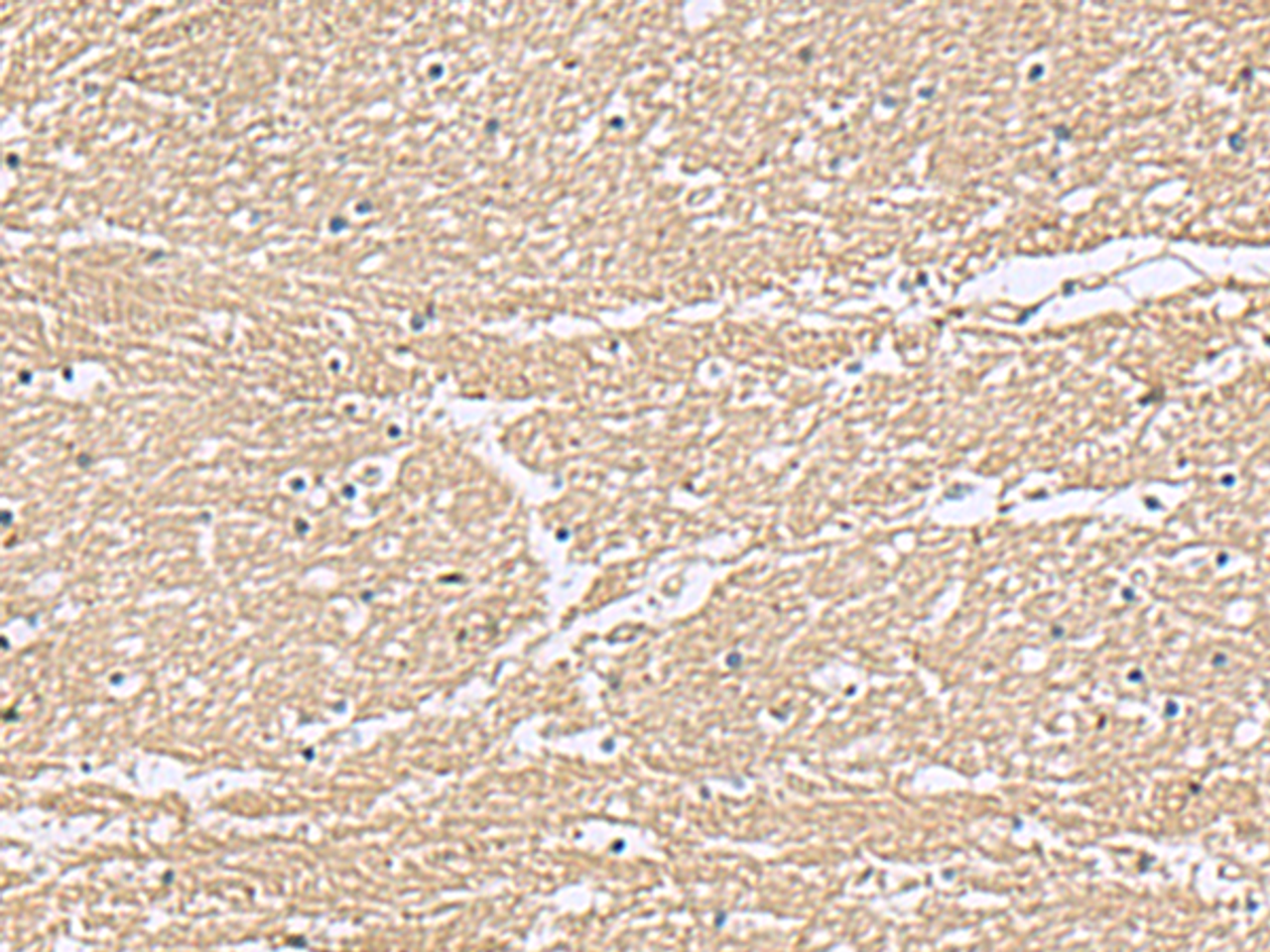 Immunohistochemistry of paraffin-embedded Human brain tissue  using KCTD7 Polyclonal Antibody at dilution of 1:55(×200)