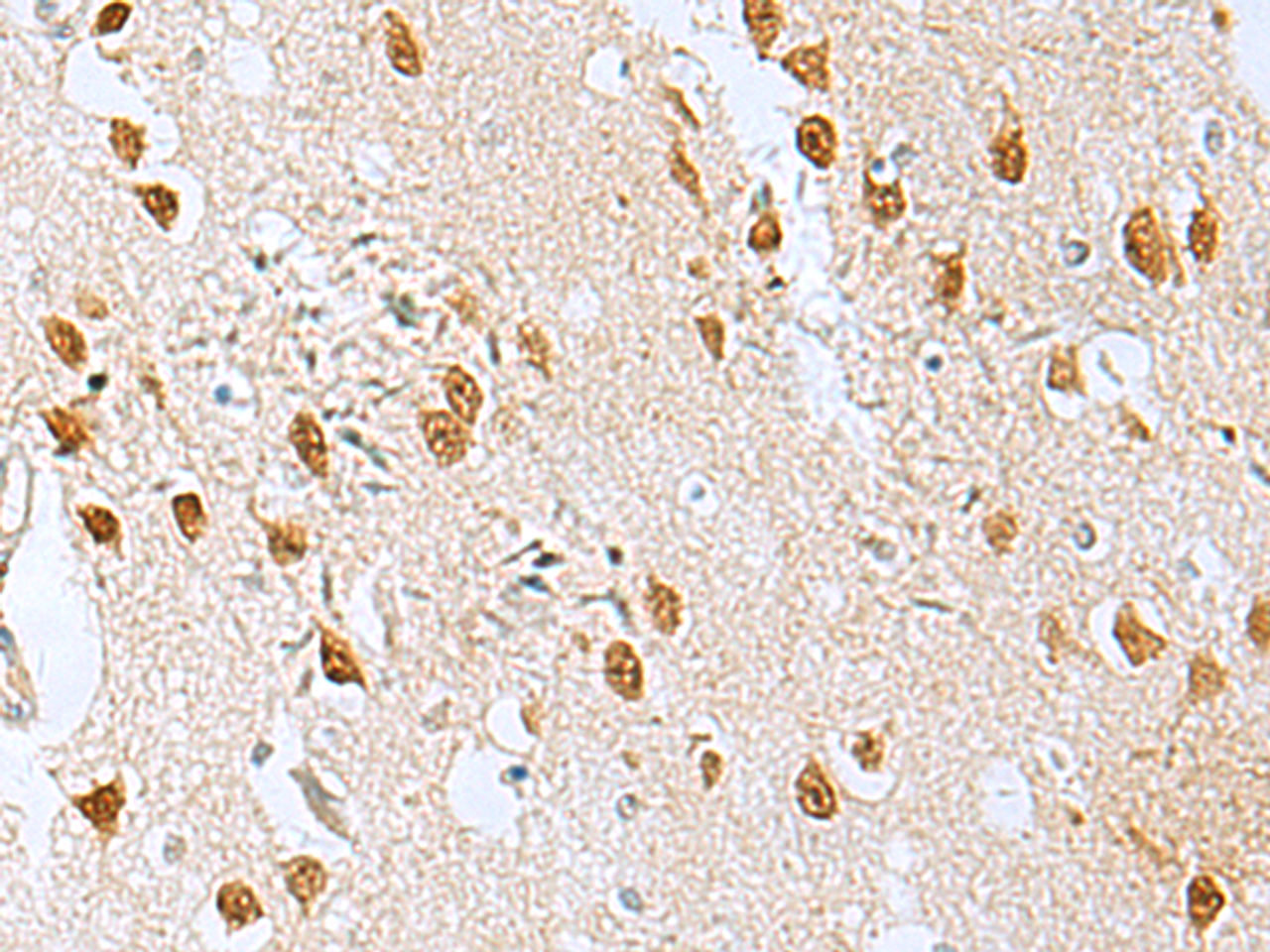 Immunohistochemistry of paraffin-embedded Human brain tissue  using KDM2B Polyclonal Antibody at dilution of 1:50(×200)