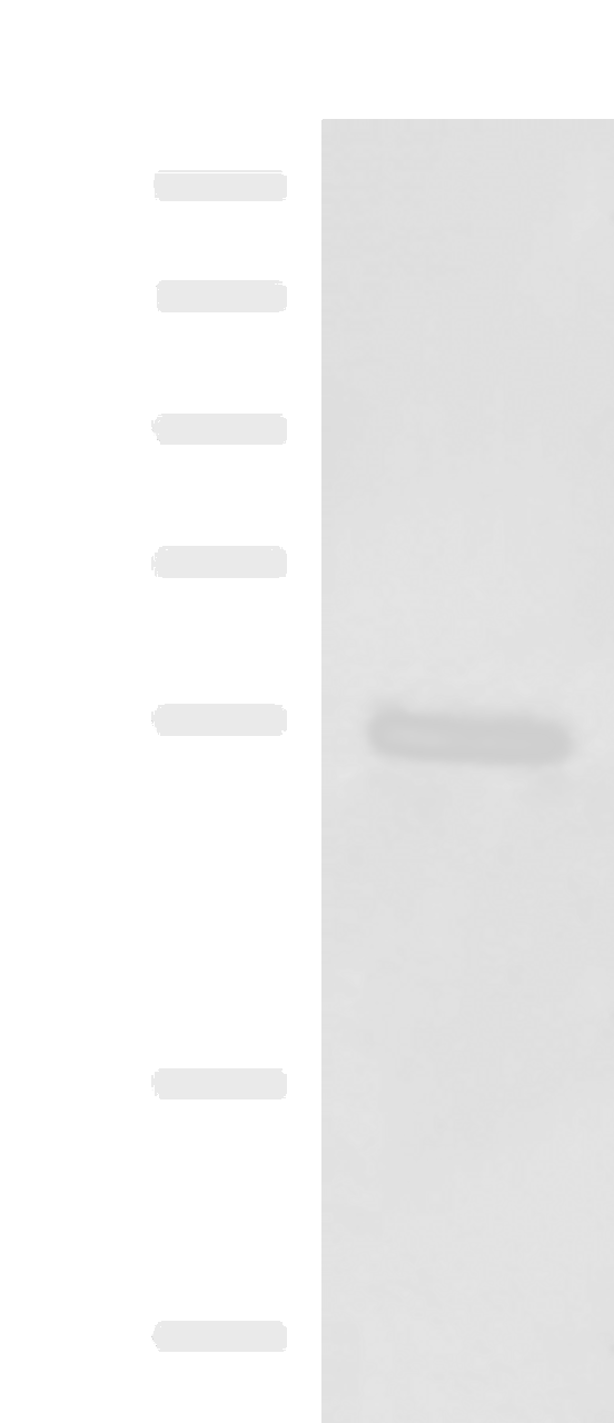 Western blot analysis of Human skin tissue lysate  using KRT36 Polyclonal Antibody at dilution of 1:1000