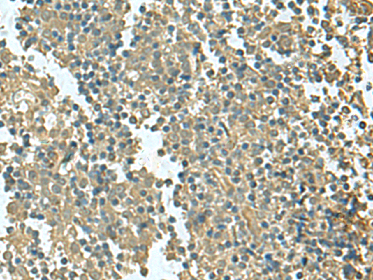 Immunohistochemistry of paraffin-embedded Human tonsil tissue  using KRT36 Polyclonal Antibody at dilution of 1:50(×200)