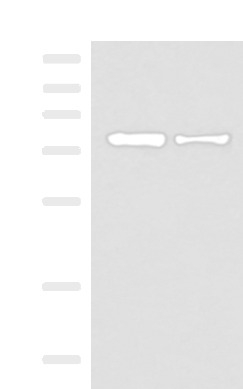 Western blot analysis of HepG2 and Hela cell lysates  using KHSRP Polyclonal Antibody at dilution of 1:1000