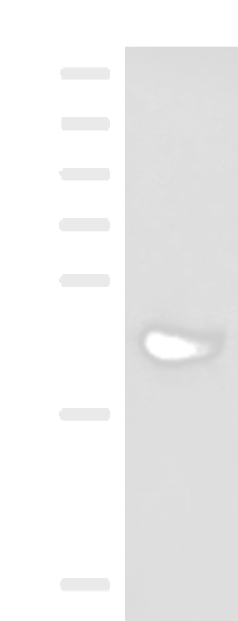 Western blot analysis of Human plasma solution  using KIR2DL5A Polyclonal Antibody at dilution of 1:1000