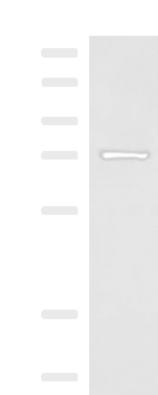 Western blot analysis of Human fetal liver tissue lysate  using SHTN1 Polyclonal Antibody at dilution of 1:600