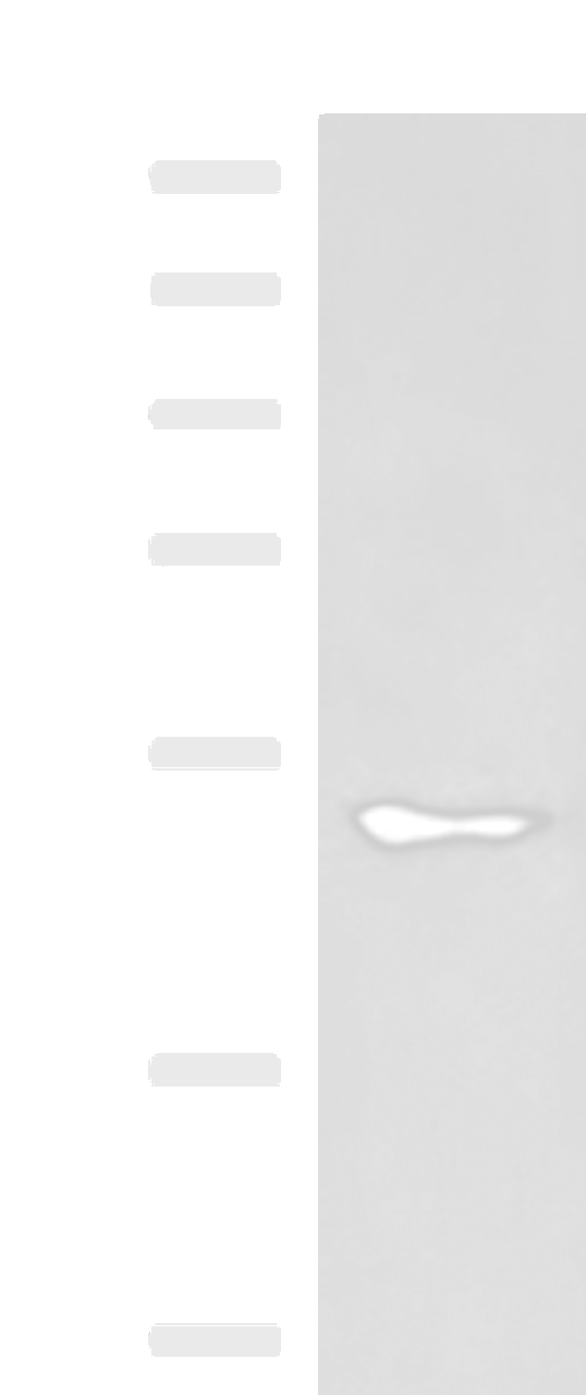 Western blot analysis of A549 cell lysate  using KCNJ2 Polyclonal Antibody at dilution of 1:550