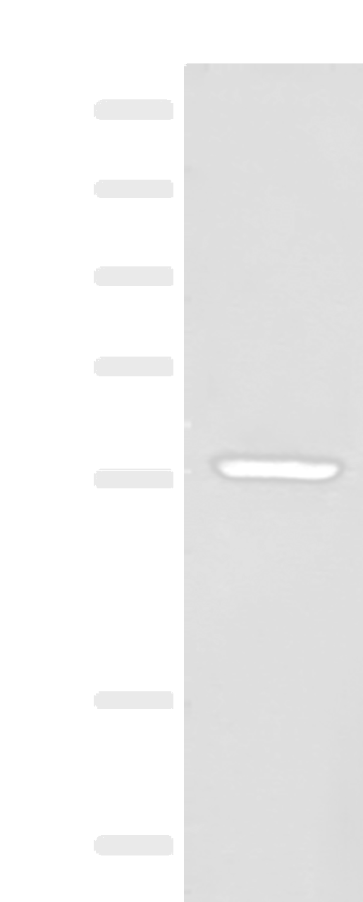 Western blot analysis of Mouse heart tissue lysate  using BAG3 Polyclonal Antibody at dilution of 1:250