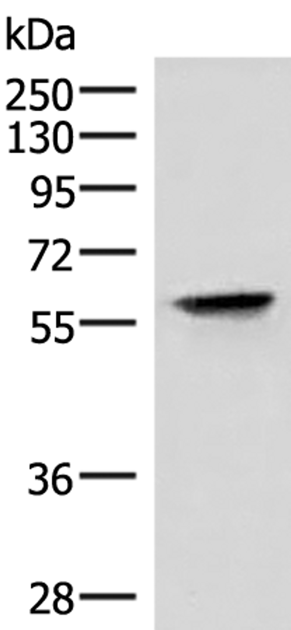 Western blot analysis of Hela cell lysate  using VIM Polyclonal Antibody at dilution of 1:4000