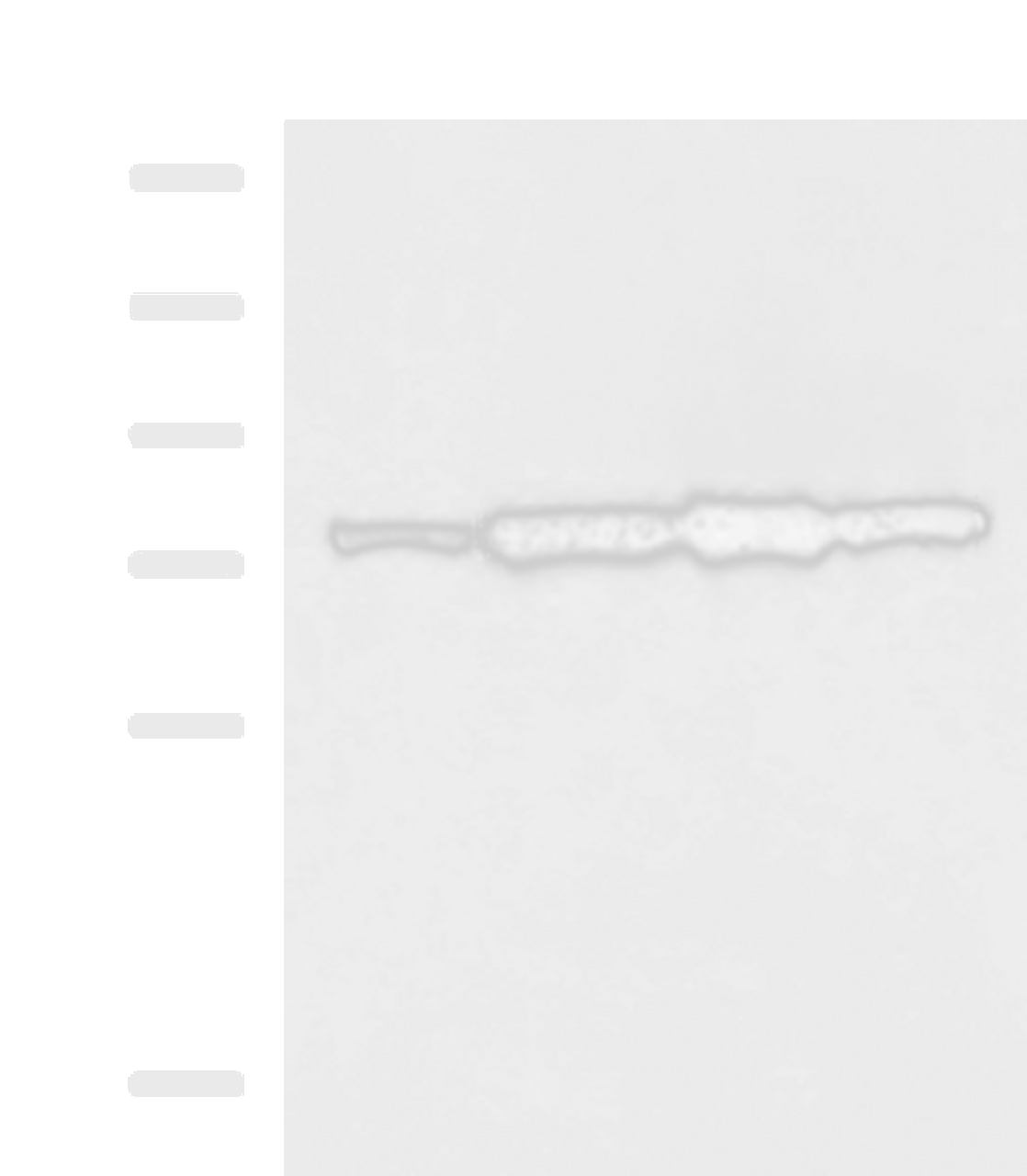 Western blot analysis of Rat heart tissue A172 cell NIH/3T3 cell TM4 cell lysates  using CAPN6 Polyclonal Antibody at dilution of 1:800