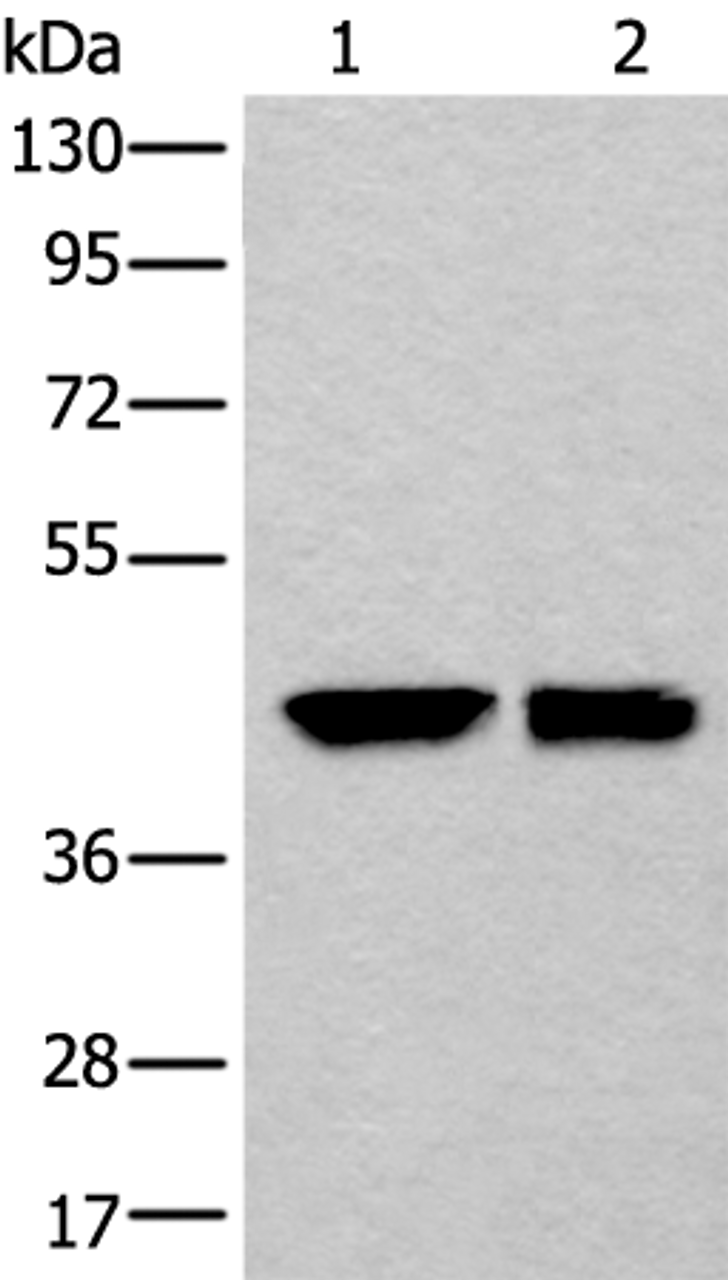 Western blot analysis of HEPG2 and 231 cell lysates  using DLK1 Polyclonal Antibody at dilution of 1:250