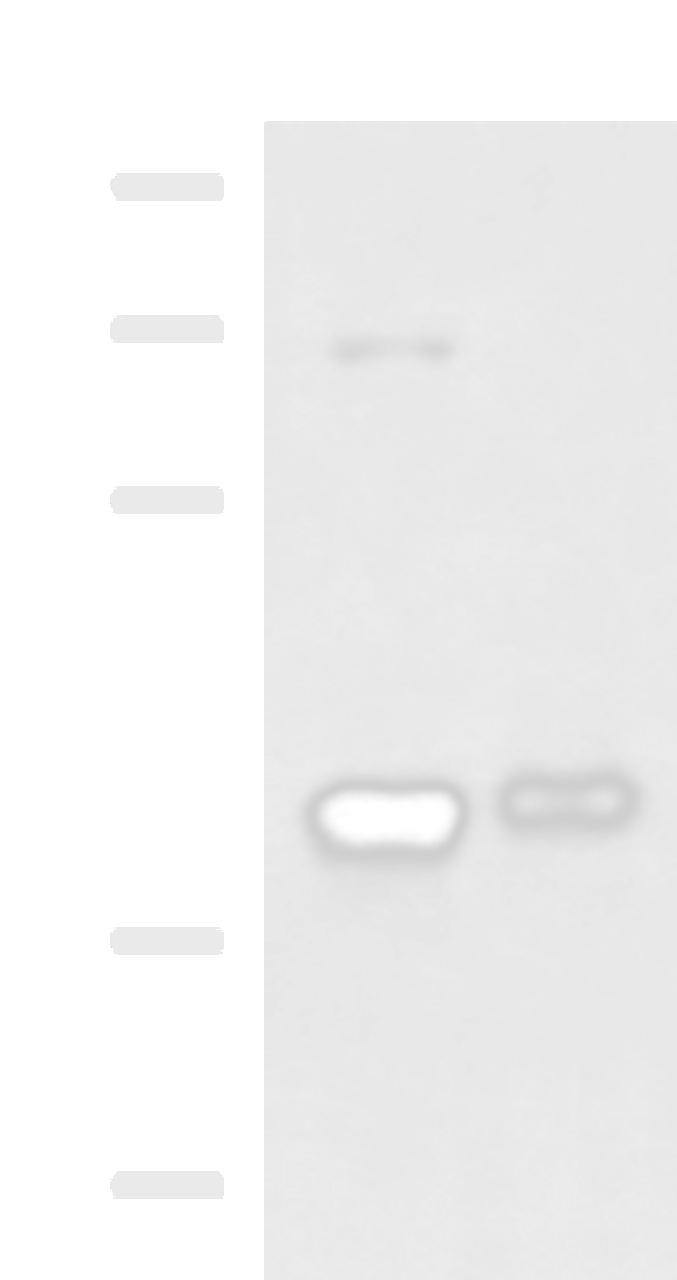 Western blot analysis of Mouse brain tissue and Human fetal brain tissue lysates  using GNAZ Polyclonal Antibody at dilution of 1:1300