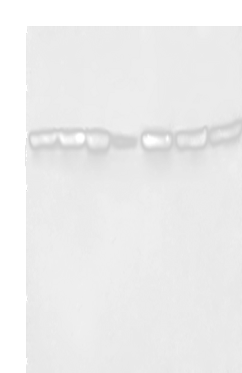 Western blot analysis of Hela cells HT29 cells human fetal liver tissue Human testis tissue 231 cells K562 cells human bladder transitional cell carcinoma tissue  using LMNB1 Polyclonal Antibody at dilution of 1:750