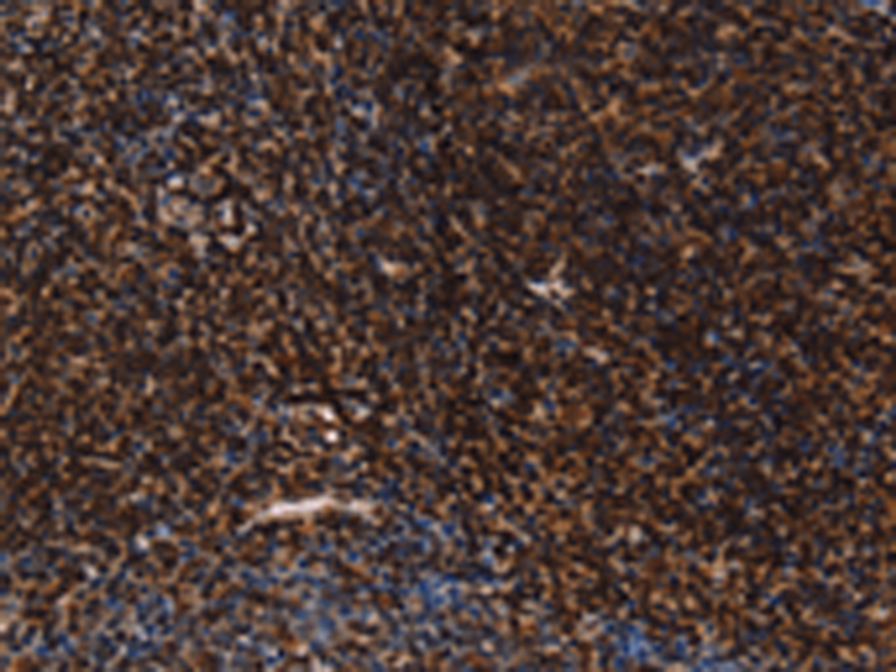 Immunohistochemistry of paraffin-embedded Human tonsil tissue  using LMNB1 Polyclonal Antibody at dilution of 1:60(×200)