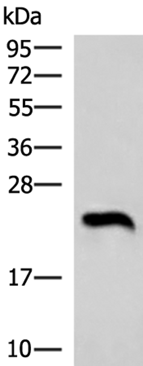 Western blot analysis of Human heart tissue lysate  using NEUROG3 Polyclonal Antibody at dilution of 1:1000