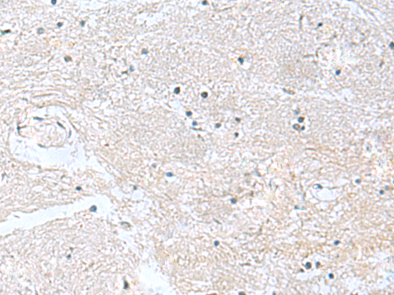 Immunohistochemistry of paraffin-embedded Human brain tissue  using CACNB1 Polyclonal Antibody at dilution of 1:100(×200)