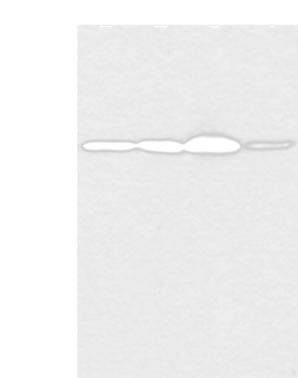 Western blot analysis of Hela and PC3 cell 231 cell and human esophagus cancer tissue  using MED6 Polyclonal Antibody at dilution of 1:400