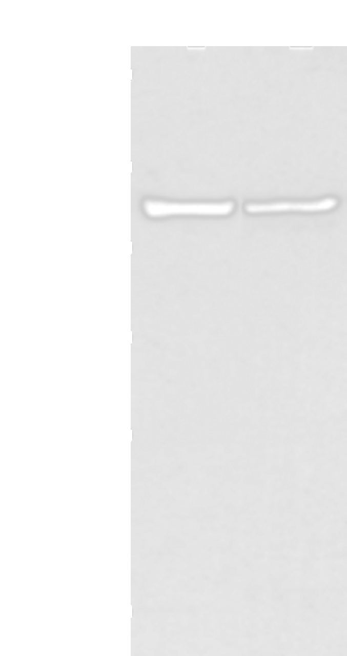 Western blot analysis of 231 and hela cell  using WWP1 Polyclonal Antibody at dilution of 1:300