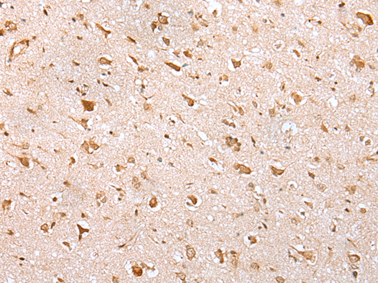 Immunohistochemistry of paraffin-embedded Human brain tissue  using YY1 Polyclonal Antibody at dilution of 1:35(×200)