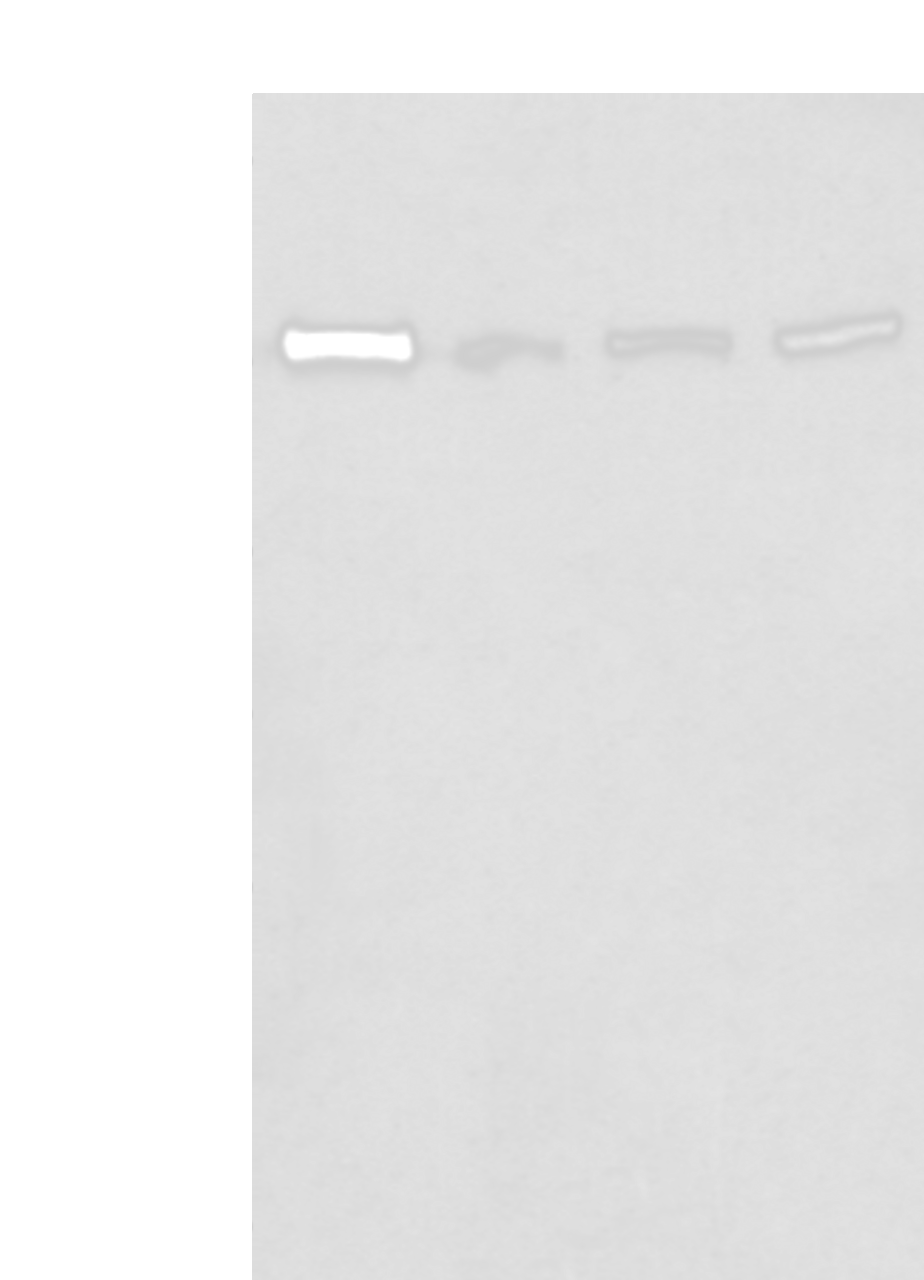 Western blot analysis of 293T Hela and A172 cell lysates  using MORC2 Polyclonal Antibody at dilution of 1:300