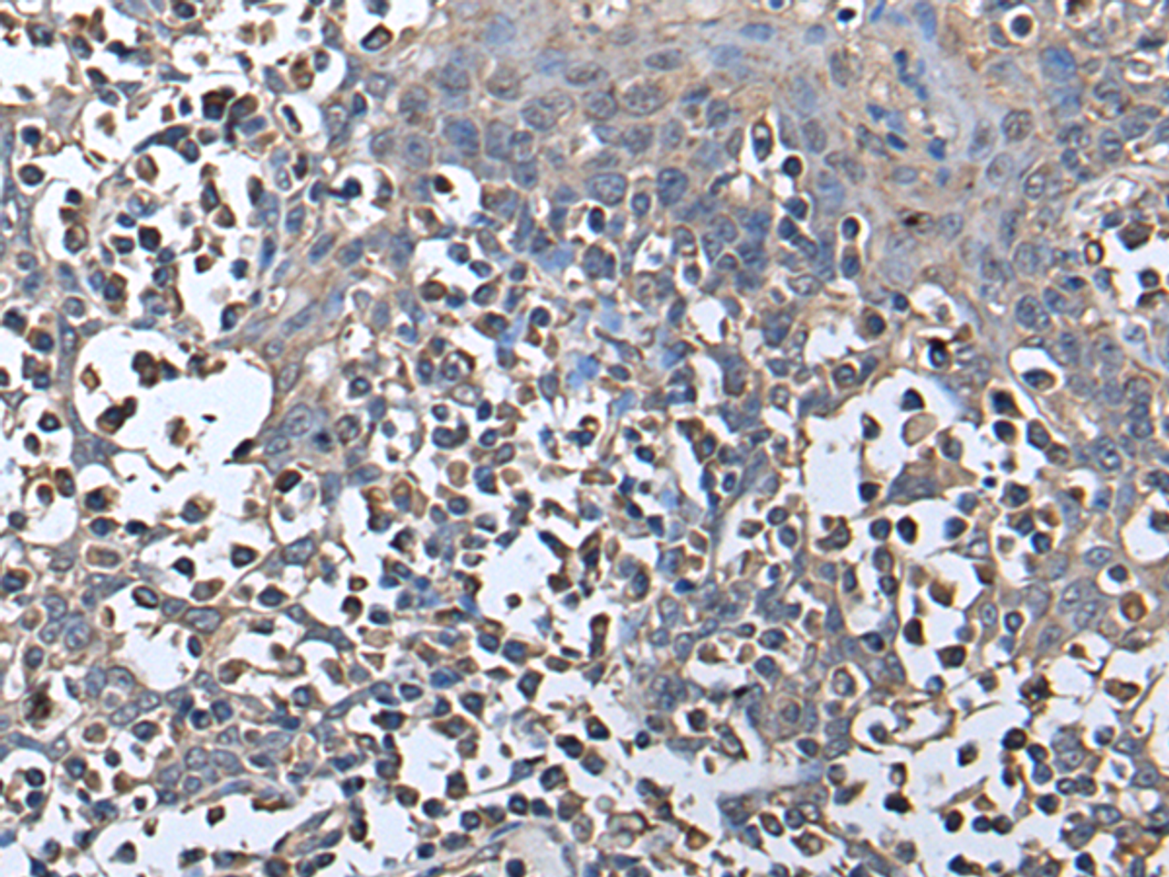 Immunohistochemistry of paraffin-embedded Human tonsil tissue  using ZNHIT1 Polyclonal Antibody at dilution of 1:40(×200)