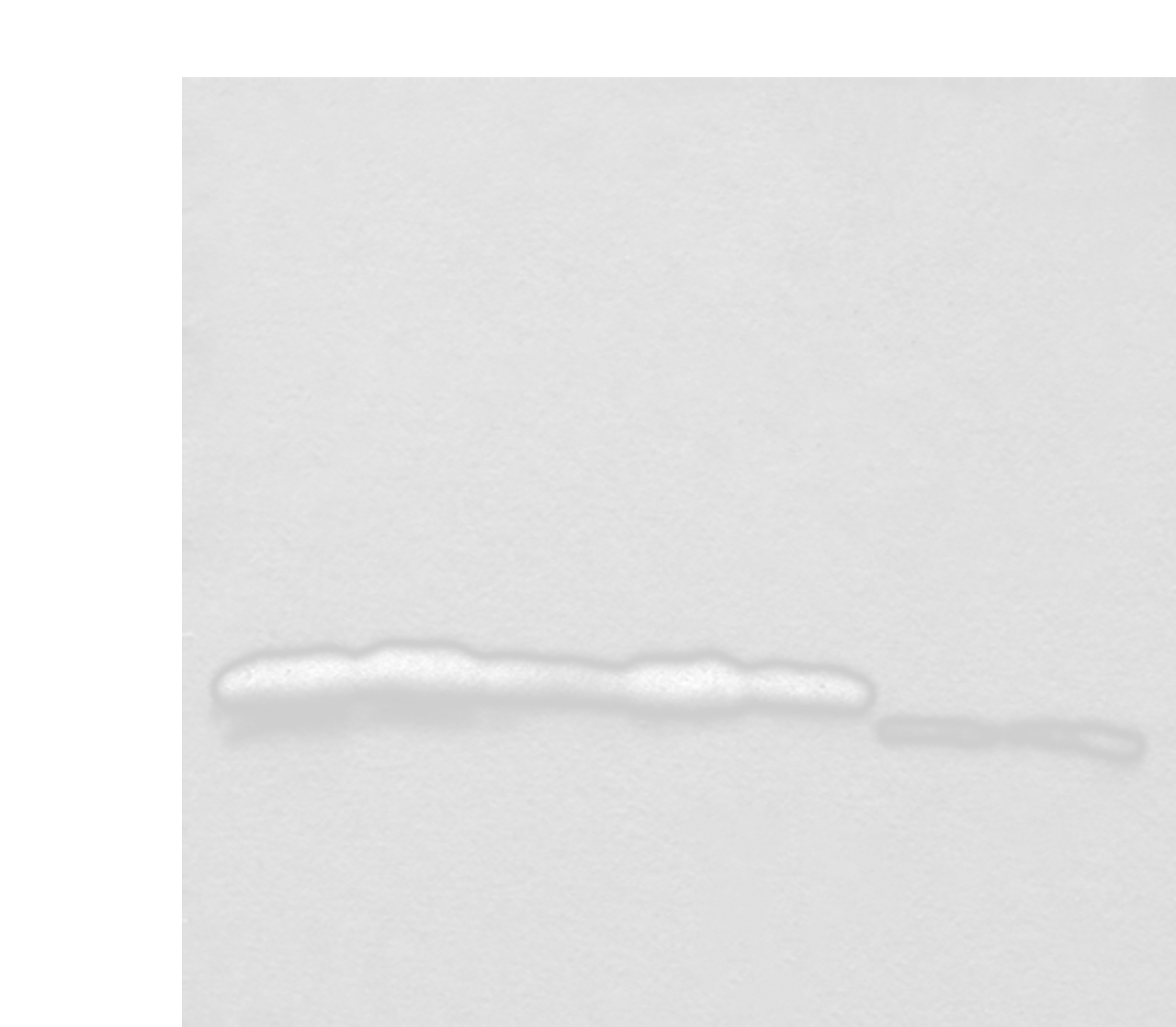 Western blot analysis of Hela HEPG2 A431 K562 and 231 cell Mouse liver tissue and Mouse brain tissue lysates  using NDUFB11 Polyclonal Antibody at dilution of 1:1000