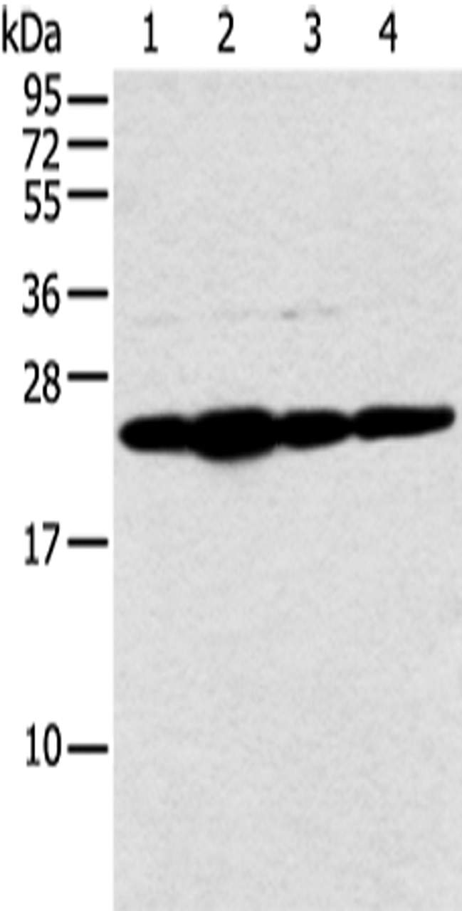 Western blot analysis of Hela cell and human fetal liver tissue A549 and Jurkat cell  using NDUFB9 Polyclonal Antibody at dilution of 1:400