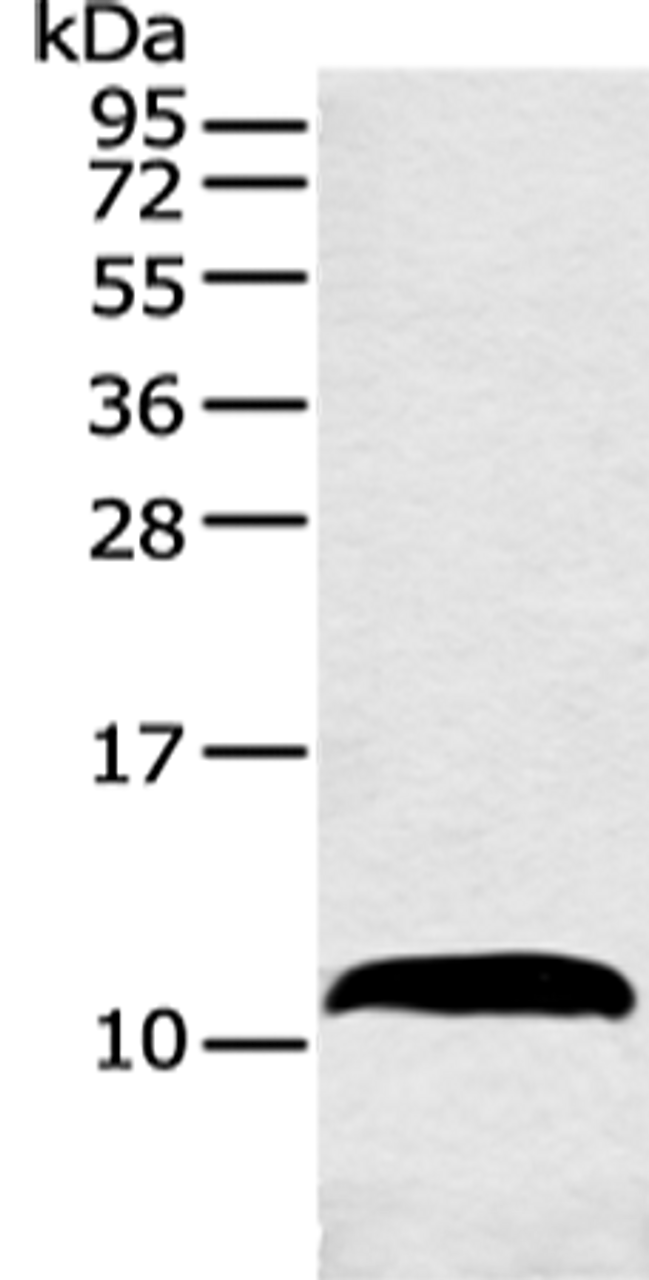 Western blot analysis of Mouse adrenal gland tissue  using HMGN3 Polyclonal Antibody at dilution of 1:550