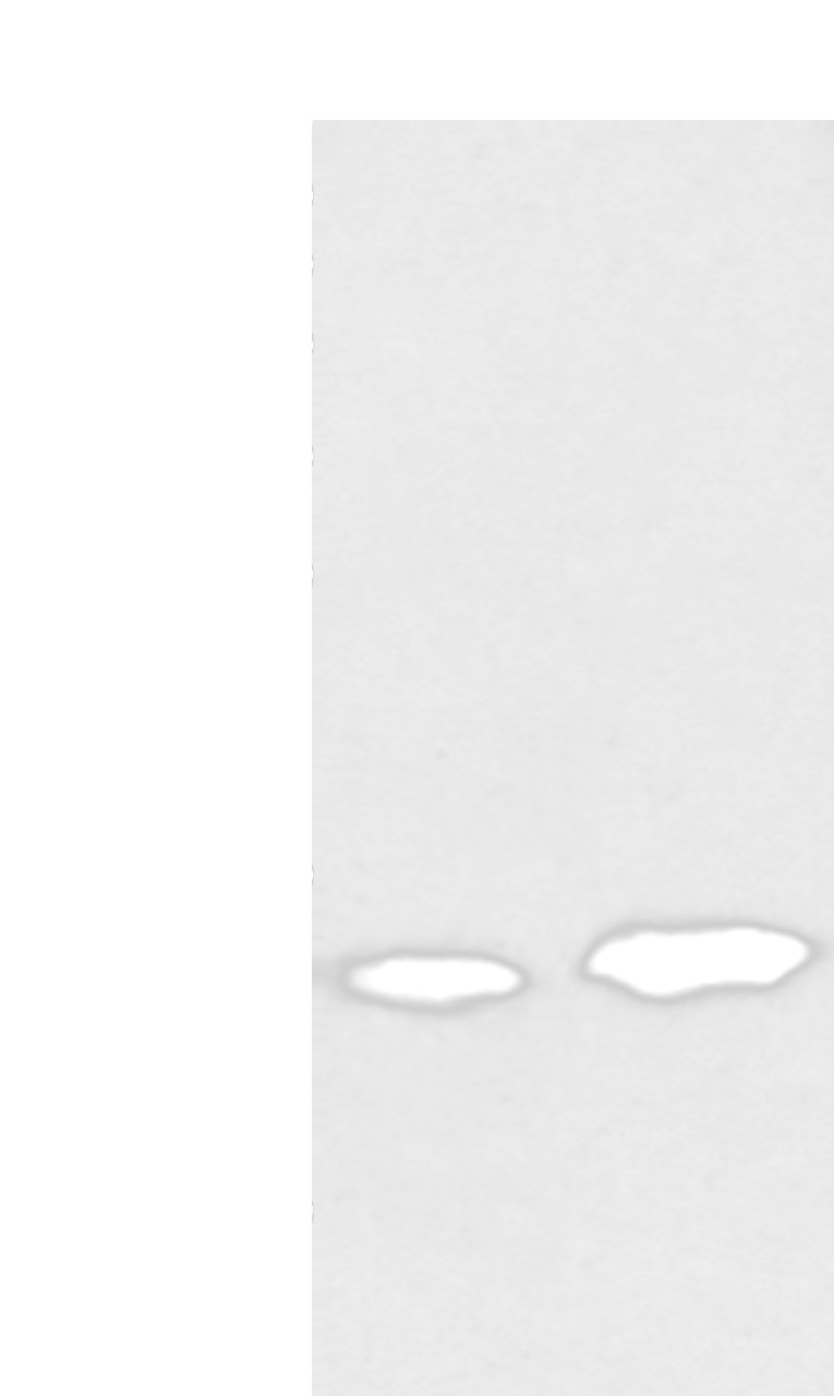 Western blot analysis of Rat heart tissue and Mouse brain tissue  using CARTPT Polyclonal Antibody at dilution of 1:350