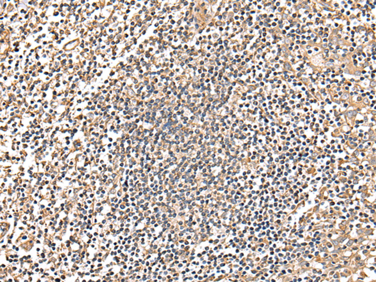 Immunohistochemistry of paraffin-embedded Human tonsil tissue  using MRPS18C Polyclonal Antibody at dilution of 1:25(×200)