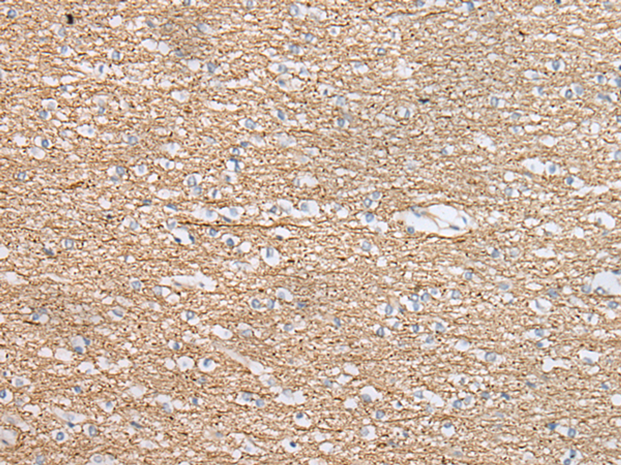 Immunohistochemistry of paraffin-embedded Human brain tissue  using IDO2 Polyclonal Antibody at dilution of 1:45(×200)